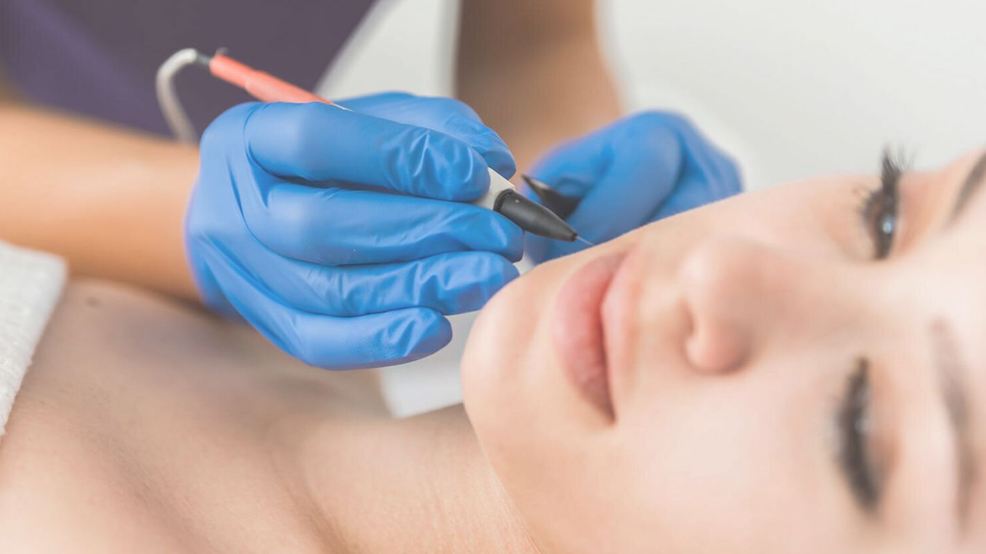 Best Electrolysis Hair Removal Treatment Langhorne, PA