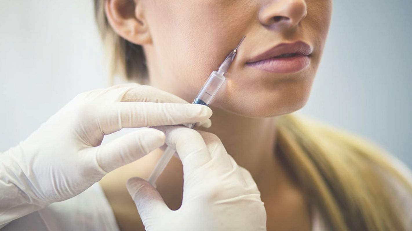 Get a Youthful Smile with Our Nasolabial Folds Injectable Treatment! Napa, CA