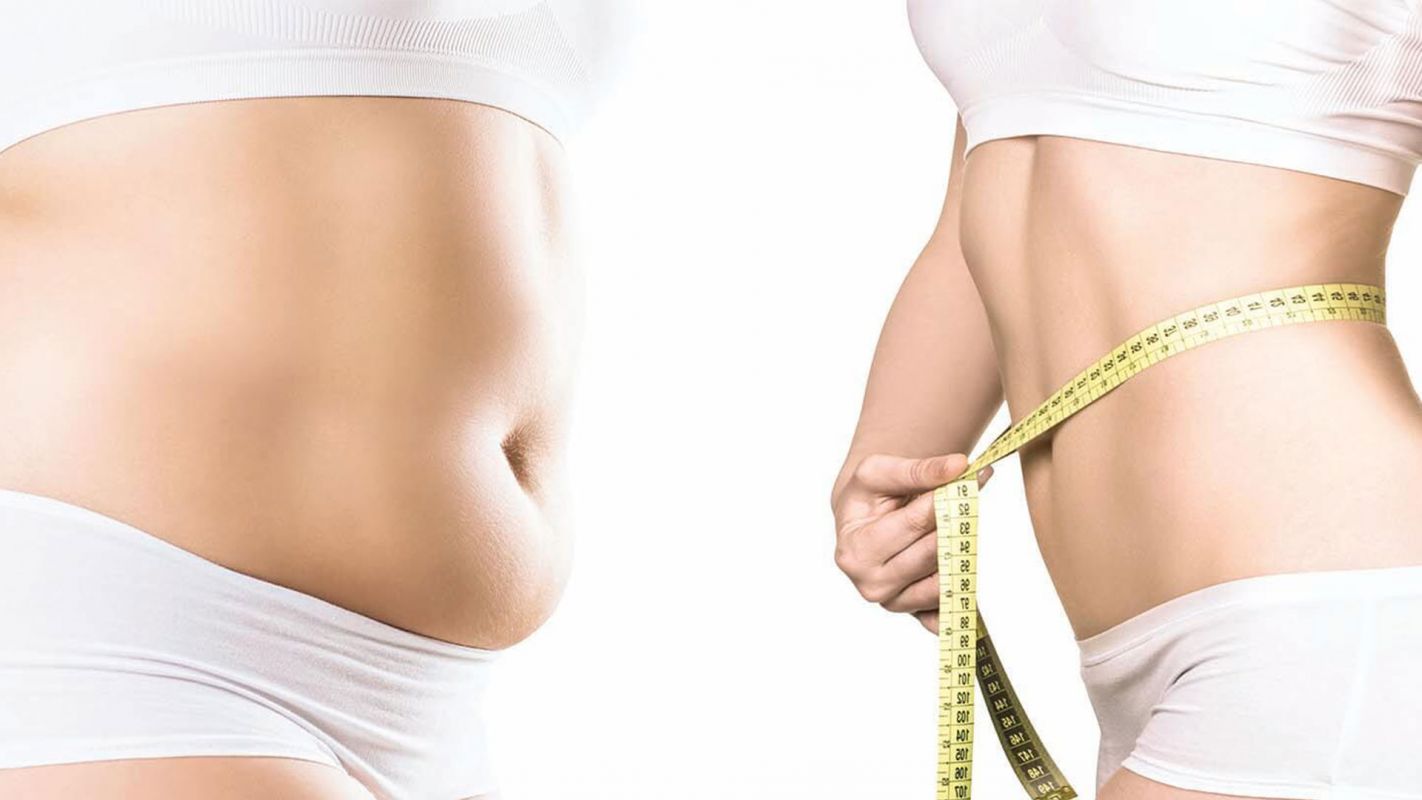 Best Body Contouring Roswell GA