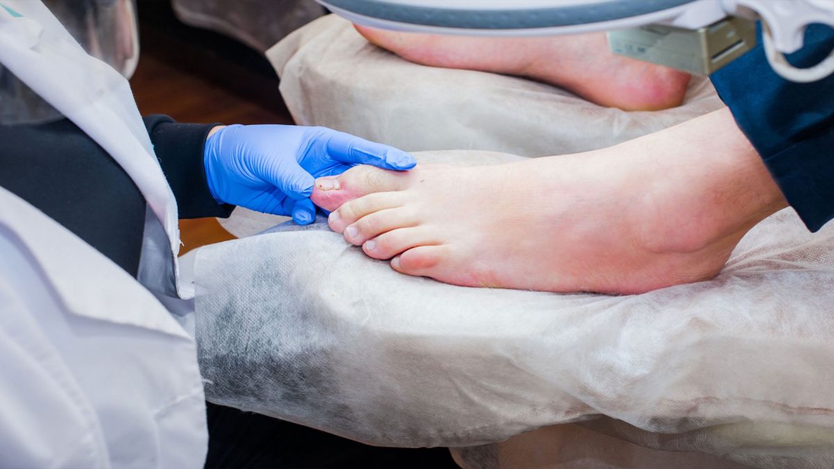 Podiatrist Foot Care Rockville MD