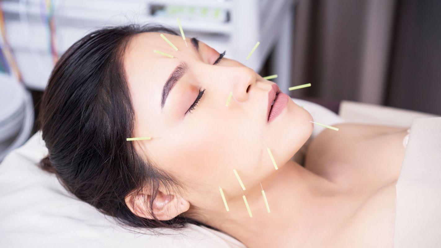 TCM Facial Rejuvenation Laurel MD