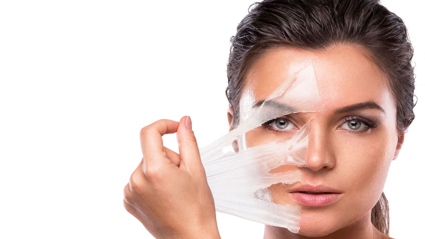 Chemical Skin Peel Midtown Atlanta GA