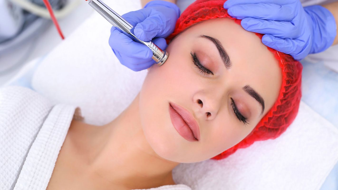 Microdermabrasion Buckhead Atlanta GA