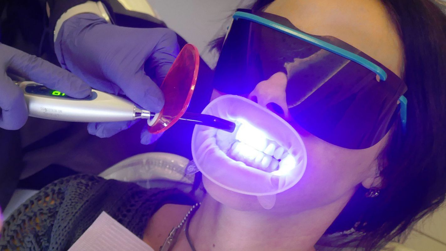 Laser Teeth Whitening Troy MI