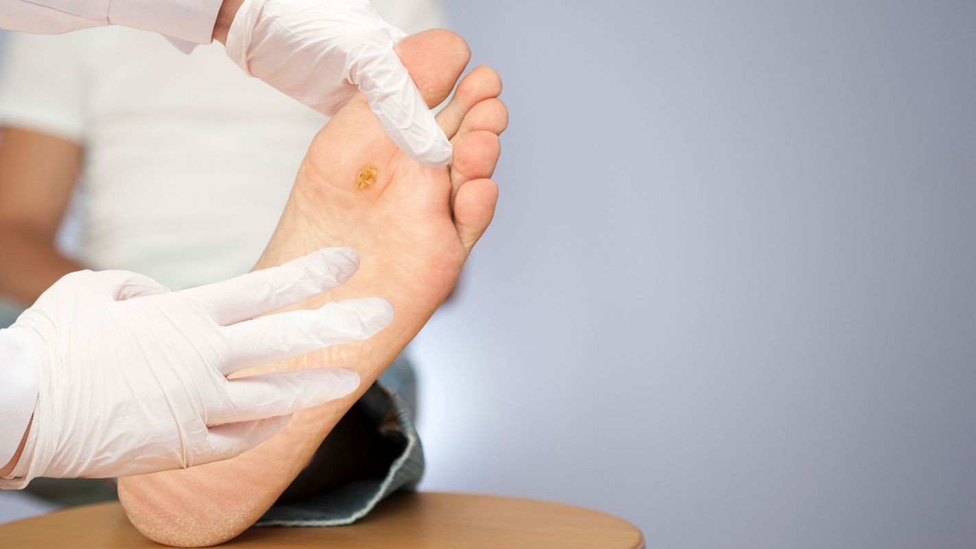 Diabetic Foot Ulcer Treatment Jackson MI