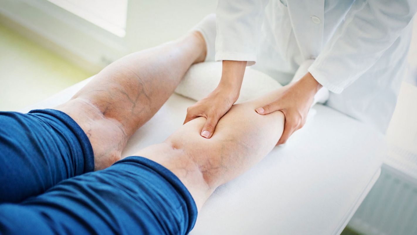 Bulging Veins Treatment Jackson MI