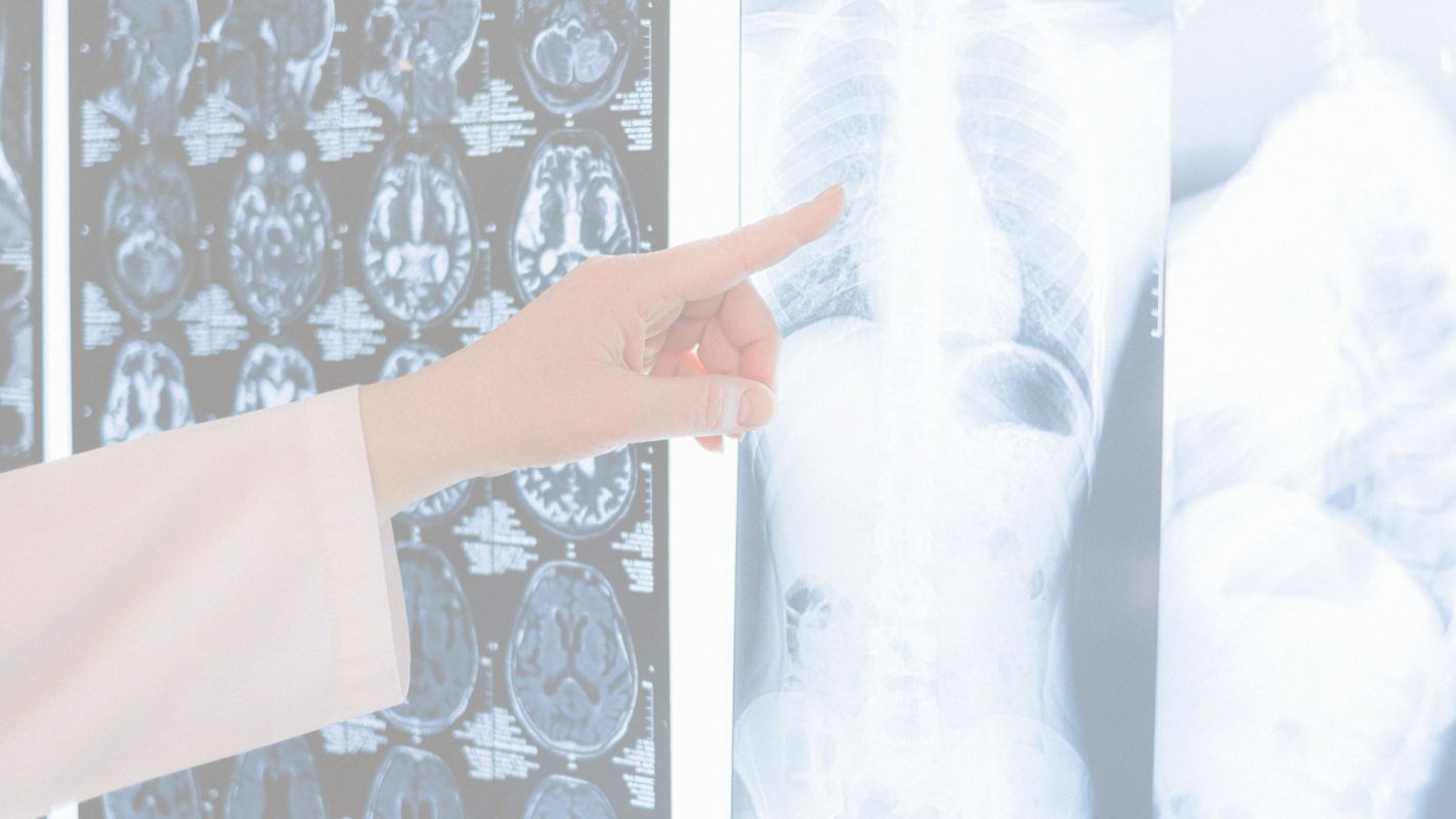 MRI Scan Services